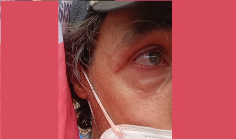Protesta contra la reforma laboral: las fuerzas represivas disparan a los ojos