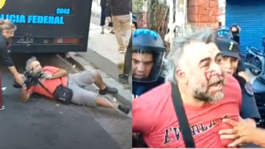 La Policía Federal calificó la agresión al camarógrafo de A24 como un «forcejeo»